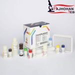 PRL 96Test(پرولاکتین) پیشتاز طب
